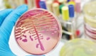 Triple-Threat Lab Test Simplifies Disease Detection