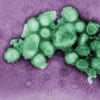 An image of a negative stained electron micrograph of the H1N1, swine flu virus.