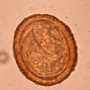 Top: Embryonated egg of <em>B. procyonis</em>, showing the developing larva inside. Bottom: Larva of <em>B. procyonis</em> hatching from an egg. Credit: DPDx