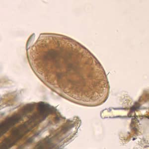 <em>Fasciola hepatica</em> egg in an unstained wet mount (400x magnification): <em>F. hepatica</em> eggs are broadly ellipsoidal, operculated, and measure 130–150 μm by 60–90 μm. (CDC Photo: DPDx)