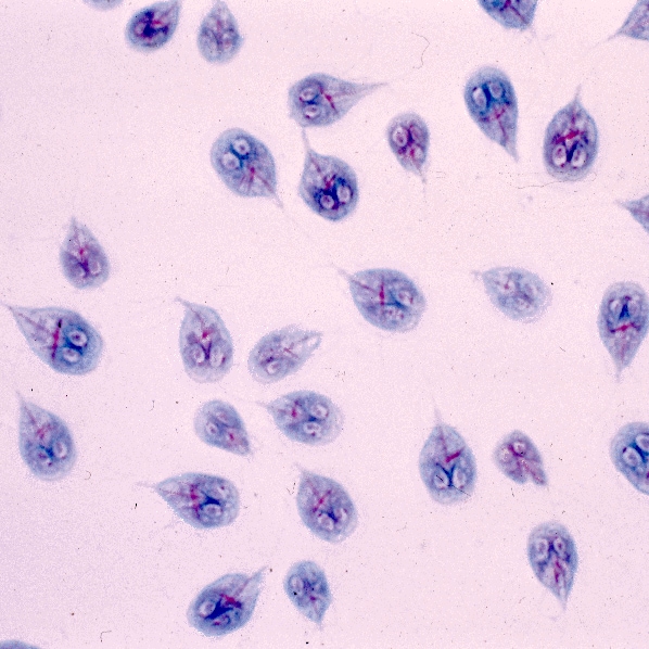G. intestinalis trophozoites in a Giemsa stained mucosal imprint. Photo credit: DPDx, CDC