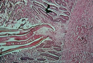 Highly magnified histologic section showing hookworm (Ancylostoma sp) attached to the intestine.