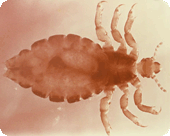 Image of a head louse under magnification.