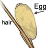 Illustration of a head lice egg