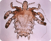 Image of a pubic louse under magnification.