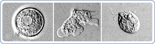 Left: EM image of Naegleria fowleri in its cyst stage. Center: EM image of Naegleria fowleri in its ameboid trophozoite stage. Right: EM image of Naegleria fowleri in its flagellated stage.