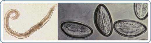 CDC - Enterobiasis
 Pinworm Eggs In Poop