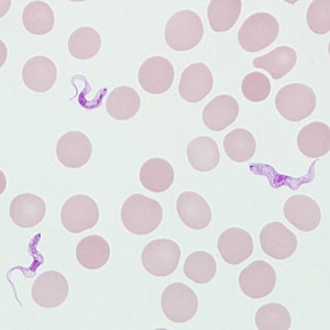 Trypomastigotes of T. brucei ssp. in a blood smear stained with Giemsa.