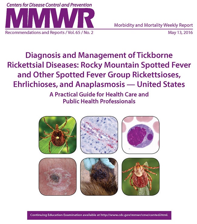 MMWR Diagnosis and Management of Tickborne Rickettsial Diseases: Rocky Mountain Spotted Fever and Other Spotted Fever Group Rickettsioses, Ehrlichioses, and Anaplasmosis - United States