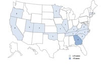 A map of the United States showing the number of people infected with an outbreak strain of Salmonella Chester by state.