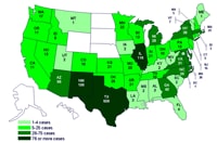 Cases infected with the outbreak strain of Salmonella Saintpaul, United States, by state, as of July 31, 2008, 9pm EDT