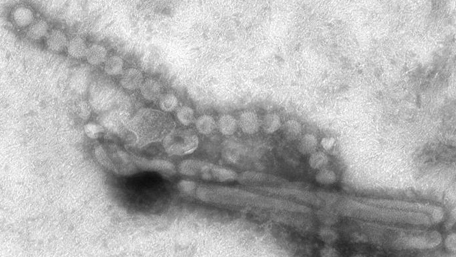 Virus H7N9