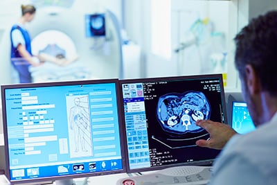 Un médico observa un escáner cerebral en un monitor de computadora.