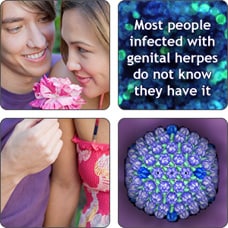 Collage of a couple and images of herpes simplex virus. Most people infected with genital herpes do now know they have it.