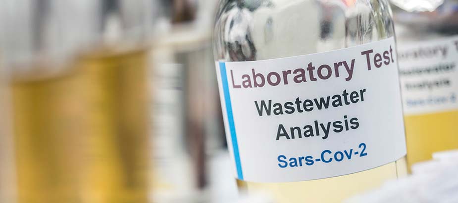 laboratory test wastewater analysis Sars-Cov-2