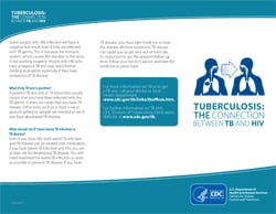 Tuberculosis: The Connection between TB and HIV (the AIDS virus)