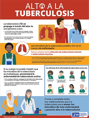 Stop TB poster Espanol