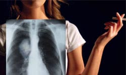 Person holding cigarette and x-ray image of lungs