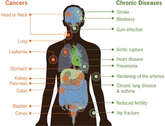 CDC Vital Signs - Tobacco Use, Smoking infographic
