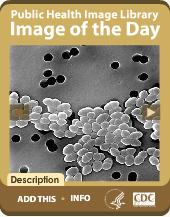 Public Health Image Library Image of the Day (Tan)