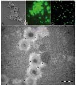 Thumbnail of As observed by scanning electronic microscopy, mimivirus antigen (A) is recognized by antibodies in our microimmunofluorescence assay using conventional fluorescence microscope (B) and confocal microscope (C). Mature particles within amebas are also recognized by antibodies seen with transmission electronic microscopy immunogold technique (D) (mimivirus particle size 400 nm).
