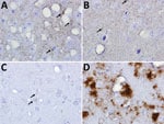 Immunohistochemical analyses of disease-associated prion protein (PrP) in the CNS of transgenic (Tg) and gene-targeted (Gt) mice infected with Finland, Norwway, and North America chronic wasting disease (CWD) isolates. A) GtQ mice (CWD-susceptible Gt mice in which the PrP coding sequence was replaced with one encoding glutamine at codon 226) infected with CWD isolate from Finland moose 1 (MF-1). B) TgE mice (Tg mice expressing cervid PrP with glutamate at residue 226) infected with M-F1. C) GtQ mice infected with CWD isolate from Norway moose 1 (M-NO1). D) GtQ mice infected with CWD isolate from US moose 1. Arrows in panels A, B, and C indicate small puncta of PrP. Immunohistochemistry sections were stained with fragment antigen binding D18. Original magnification ×10. 