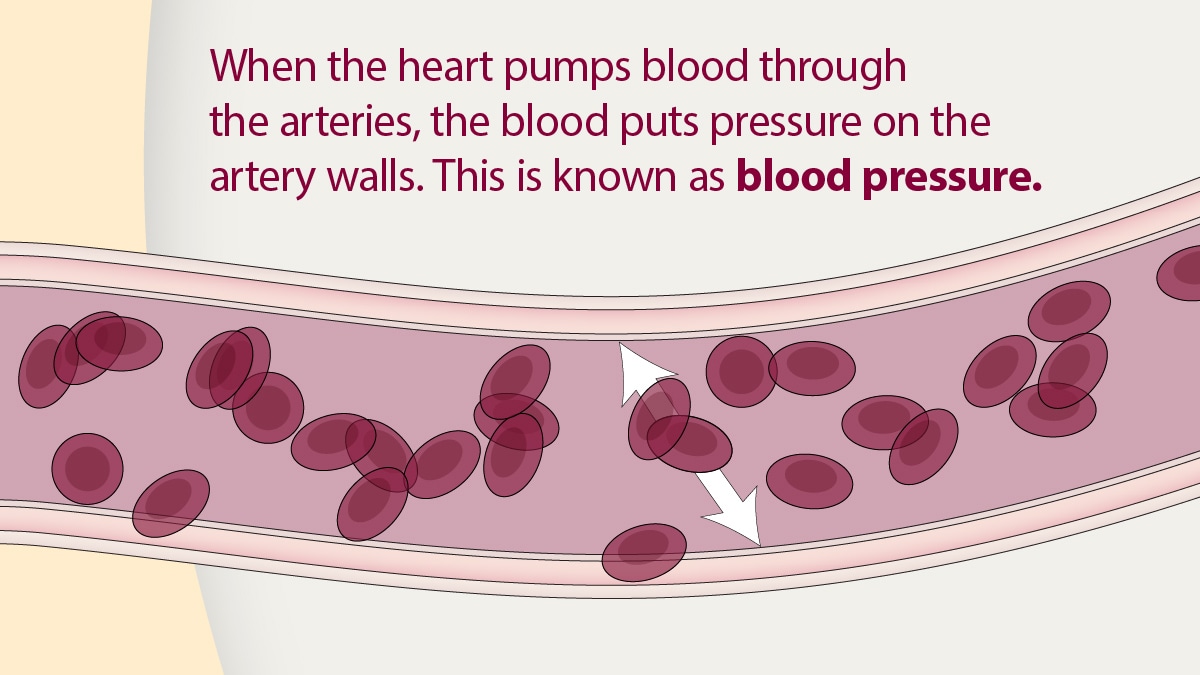 When the heart pumps blood through the arteries, the blood puts pressure on the artery walls. This is known as blood pressure.