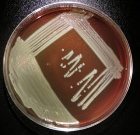 Elizabethkingia bacteria streaked on an agar plate.