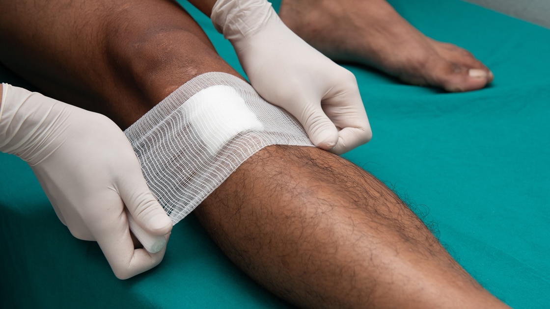 Healthcare professional bandaging a knee