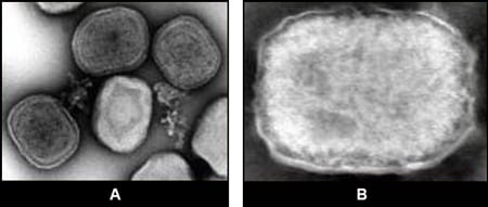 Figure 4: 4-A: EM of fowlpox virus, tissue culture specimen, showing 3 virions with %26ldquo;C%26rdquo; form. 4-B: EM of tanapox virus, clinical specimen (enveloped virion).