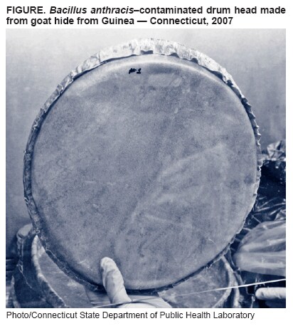 FIGURE. Bacillus anthraciscontaminated drum head made from goat hide from Guinea  Connecticut, 2007