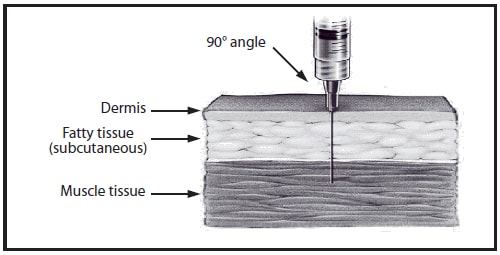 This drawing shows intramuscular needle insertion into a cross-section of skin. The needle is inserted at a 90-degree angle and penetrates the dermis, fatty tissue (subcutaneous), and muscle tissue.