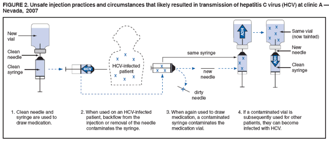 FIGURE 2. Unsafe injection practices and circumstances that likely resulted in transmission of hepatitis C virus (HCV) at clinic A 
Nevada, 2007
