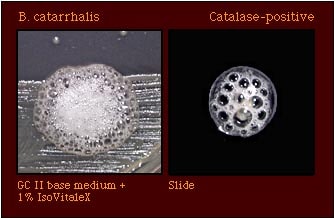 Catalase Test (Reaction with 3% hydrogen peroxide)