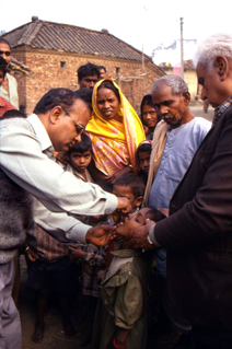 An oral polio vaccine dosage being given to a child