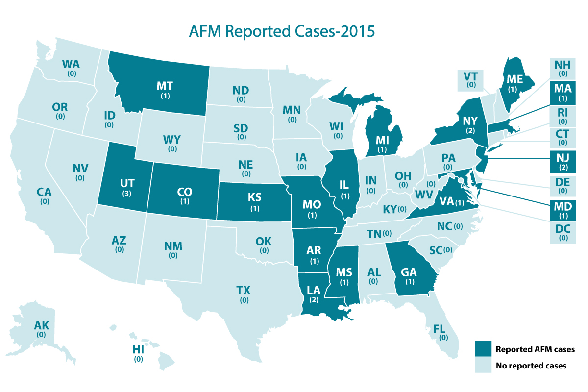 Afm Cases And Outbreaks Cdc Map Showing Afm Cases By State 2022