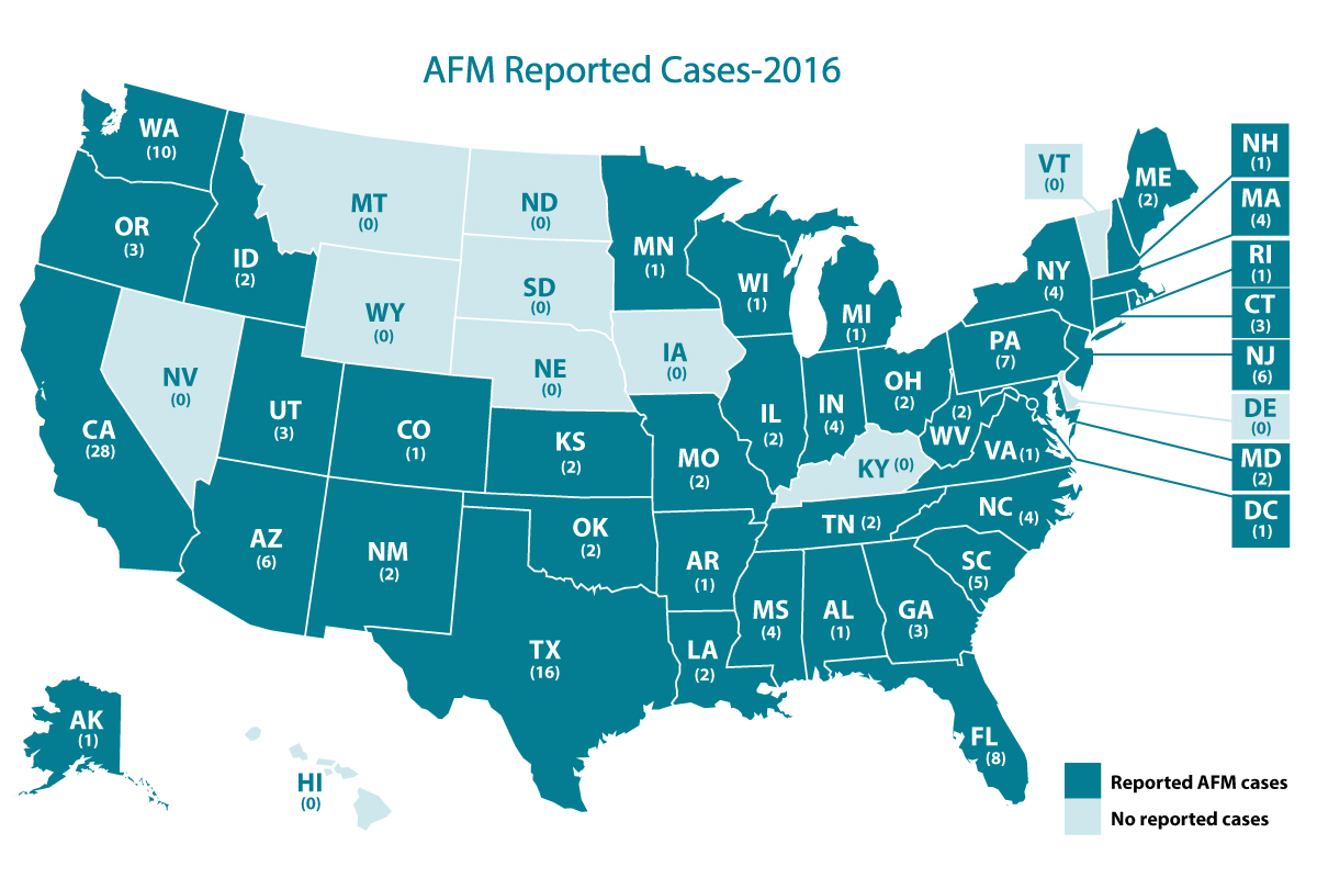 Afm Cases And Outbreaks Cdc Map Showing Afm Cases By State 2022