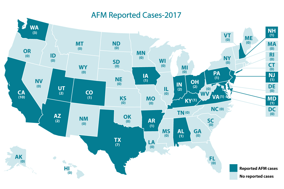 Afm Cases And Outbreaks Cdc Map Showing Afm Cases By State 2022