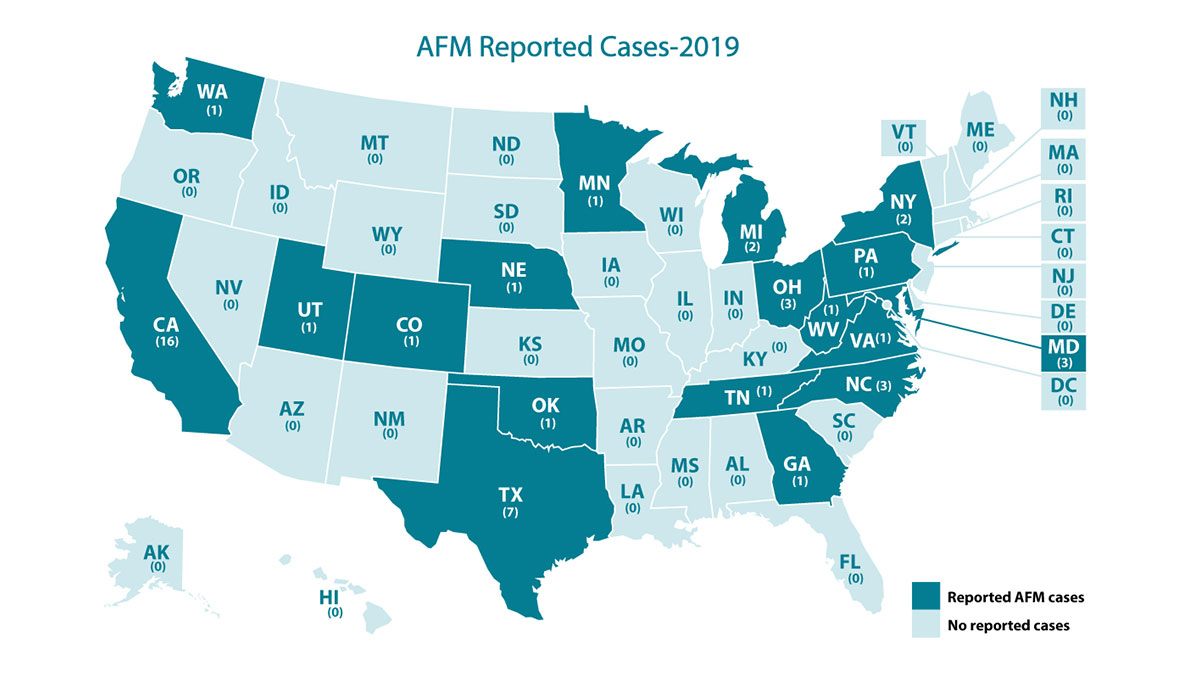 Afm Cases And Outbreaks Cdc Map Showing Afm Cases By State 2022