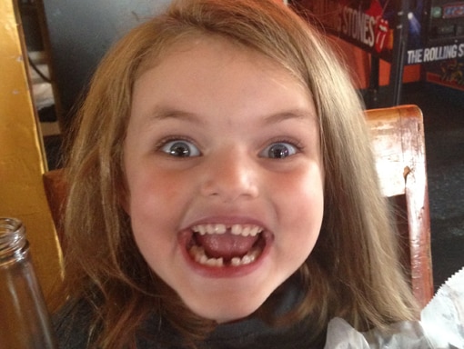 Lauren showing her missing tooth.