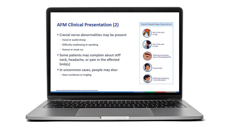 laptop with a slide from CDC's AFM presentation