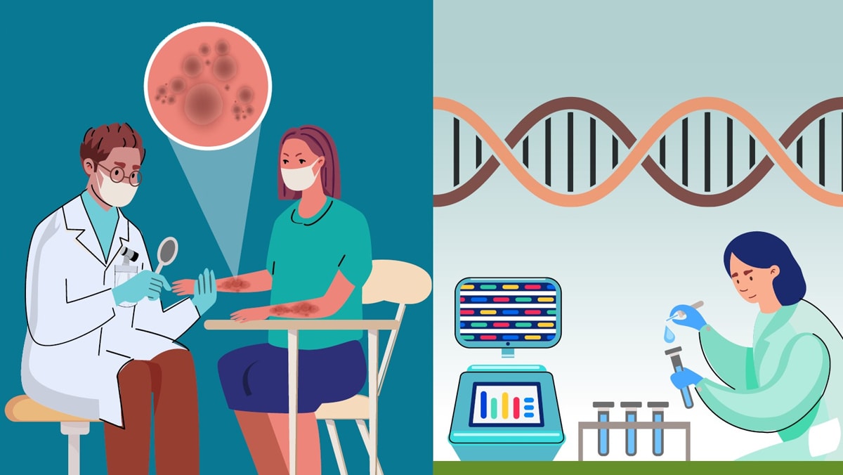 Illustration of doctor examining ringworm on a patint's skin and a scientist sequencing dna from a sample