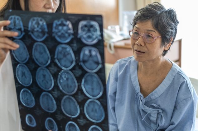Brain disease diagnosis with medical doctor diagnosing elder