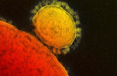 Electron micrograph of novel coronavirus that appears as yellow and orange circular shapes on a black background. 