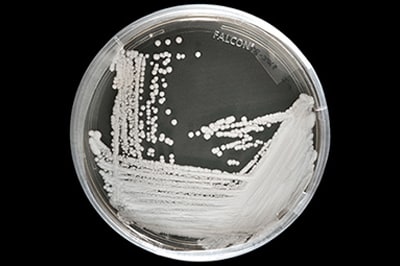 Closeup image of candida auris smeared on a petri dish against black background