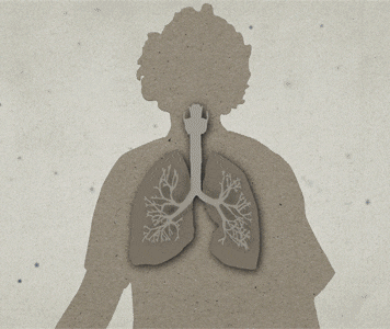 GIF animado que muestra esporas de ántrax entrando en los pulmones e infectando a la persona de la ilustración 