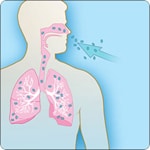 Ilustración de un humano inhalando esporas de ántrax a través de la nariz y hacia los pulmones     
