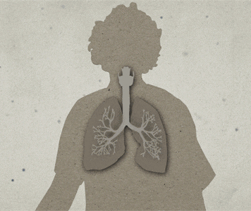 Animated gif showing anthrax spores entering lungs and infecting an illustrated person.