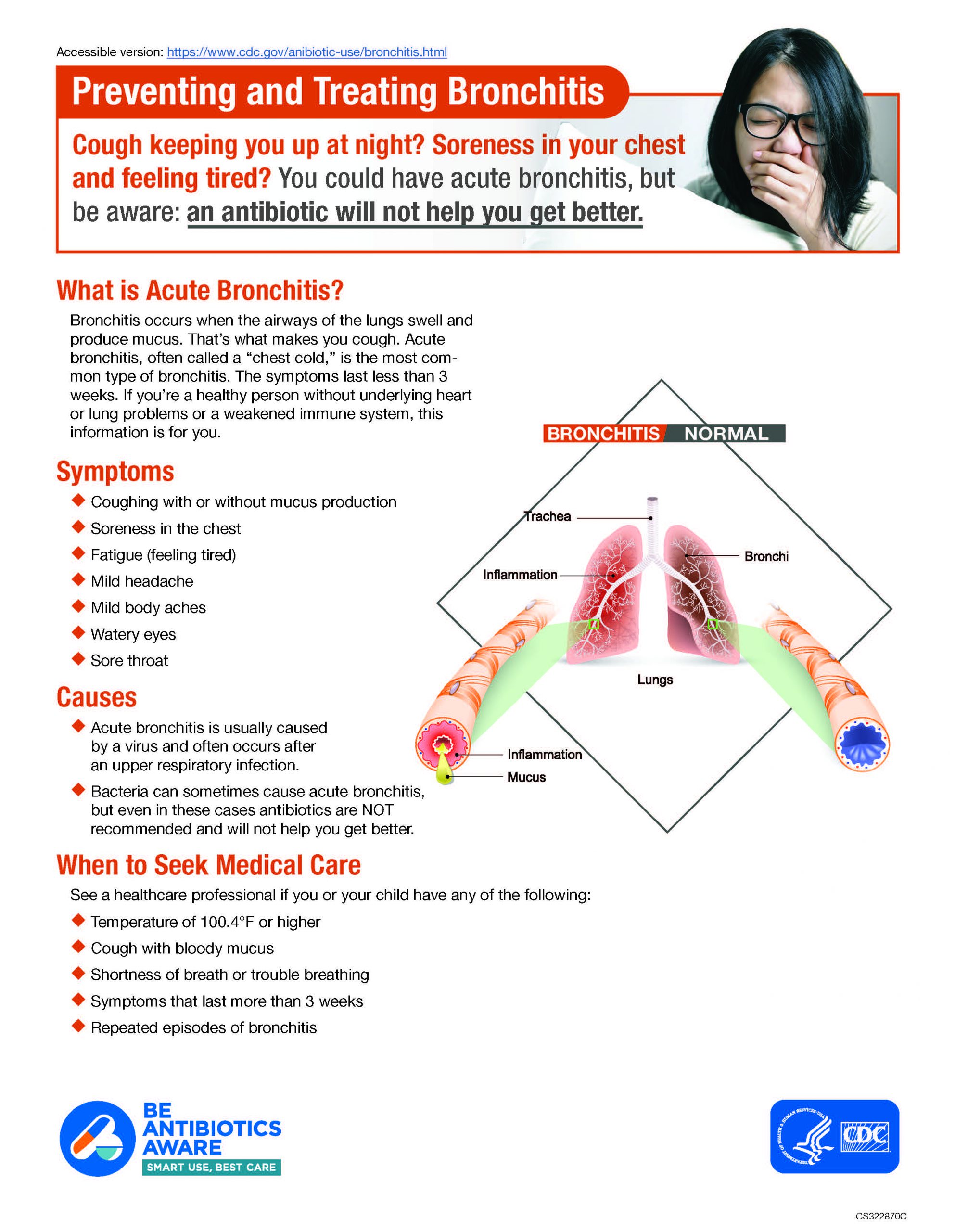 Preventing and Treating Bronchitis