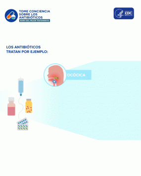 Quejar Polo Almuerzo Bronquitis aguda (resfriado de pecho) | Prescripción y uso de antibióticos  | CDC